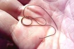 Parasite dans votre paume