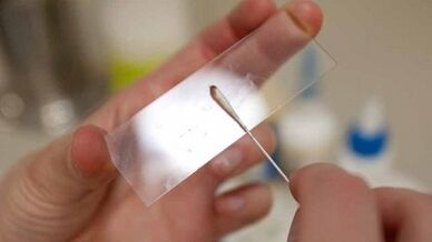 Analyse Calais pour identifier les parasites