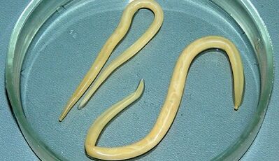 Comment effectuer correctement les tests pour ascariasis