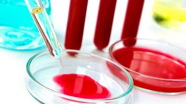 Test sanguin pour les parasites